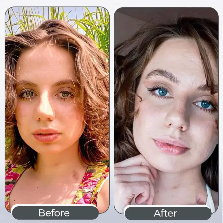 Black Friday Sale 50%💦BOMAZE™ - Color Changing Eye Drops